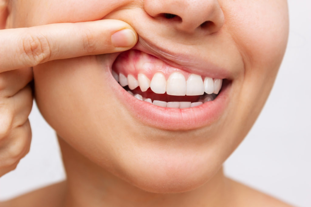 Co poškozuje zuby?